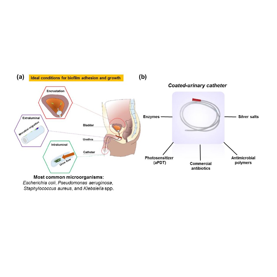 Self-disinfecting urethral catheter to overcome urinary infections: from antimicrobial photodynamic action to antibacterial biochemical entities.