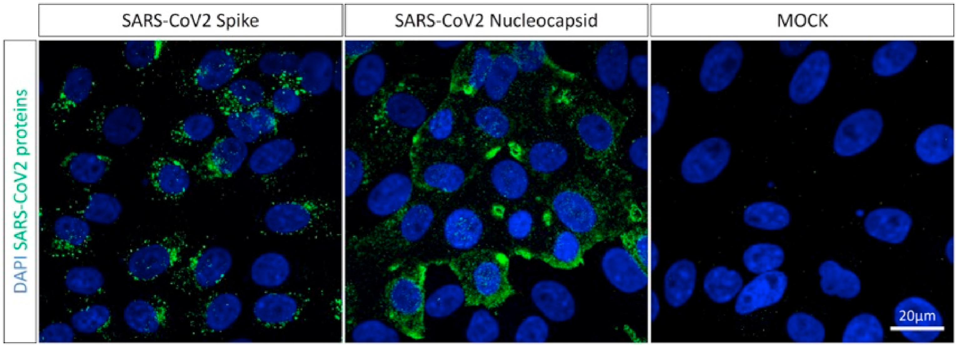 Enhanced performance of impedimetric immunosensors to detect SARS-CoV-2 with bare gold nanoparticles and graphene acetic acid.