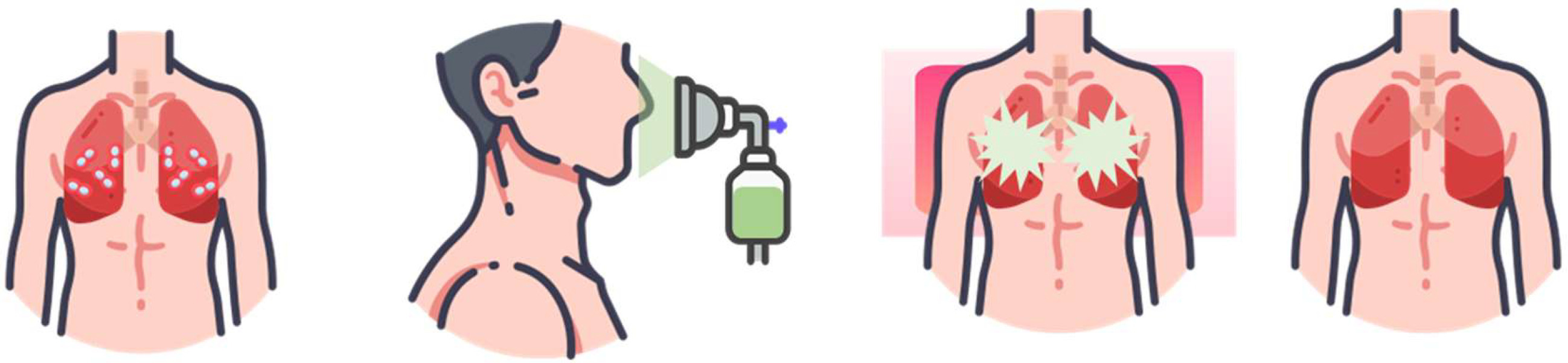 Strategies for overcoming the lung surfactant barrier and achieving success in antimicrobial photodynamic therapy.