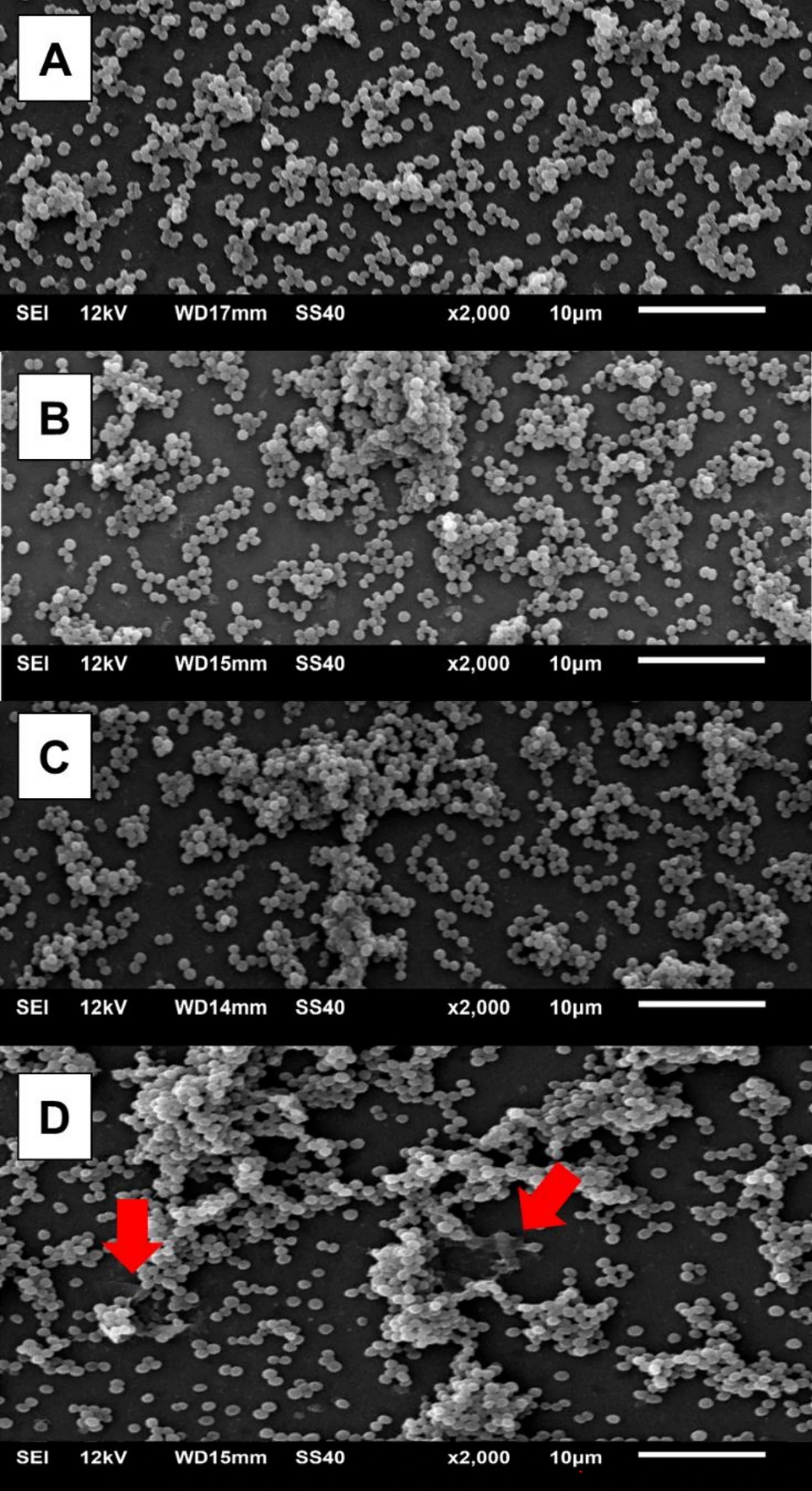 Exploring catalase inhibition as an adjuvant to antimicrobial photodynamic therapy against Staphylococcus aureus.