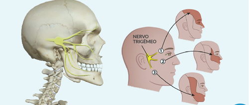 Laser de baixa potência trata dores orofaciais - neuralgia do trigêmeo -  Portal IFSC